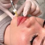 perfilamiento labios